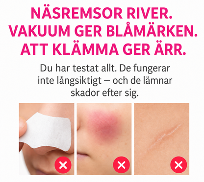 HealSkin® - Rena porer utan att klämma